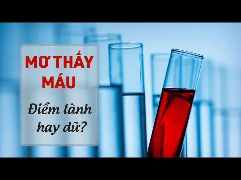 Giải mã chi tiết khi nằm mơ thấy chảy máu